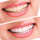 Pre-Order White Bright - Now Teeth Whitening Changes Forever